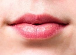 Wrinkles Above the Lips: The Best Treatments & Prevention